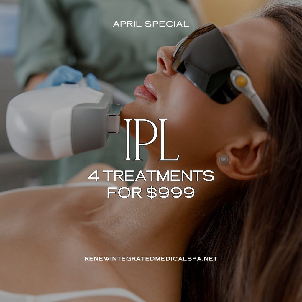 IPL (4 Treatments)