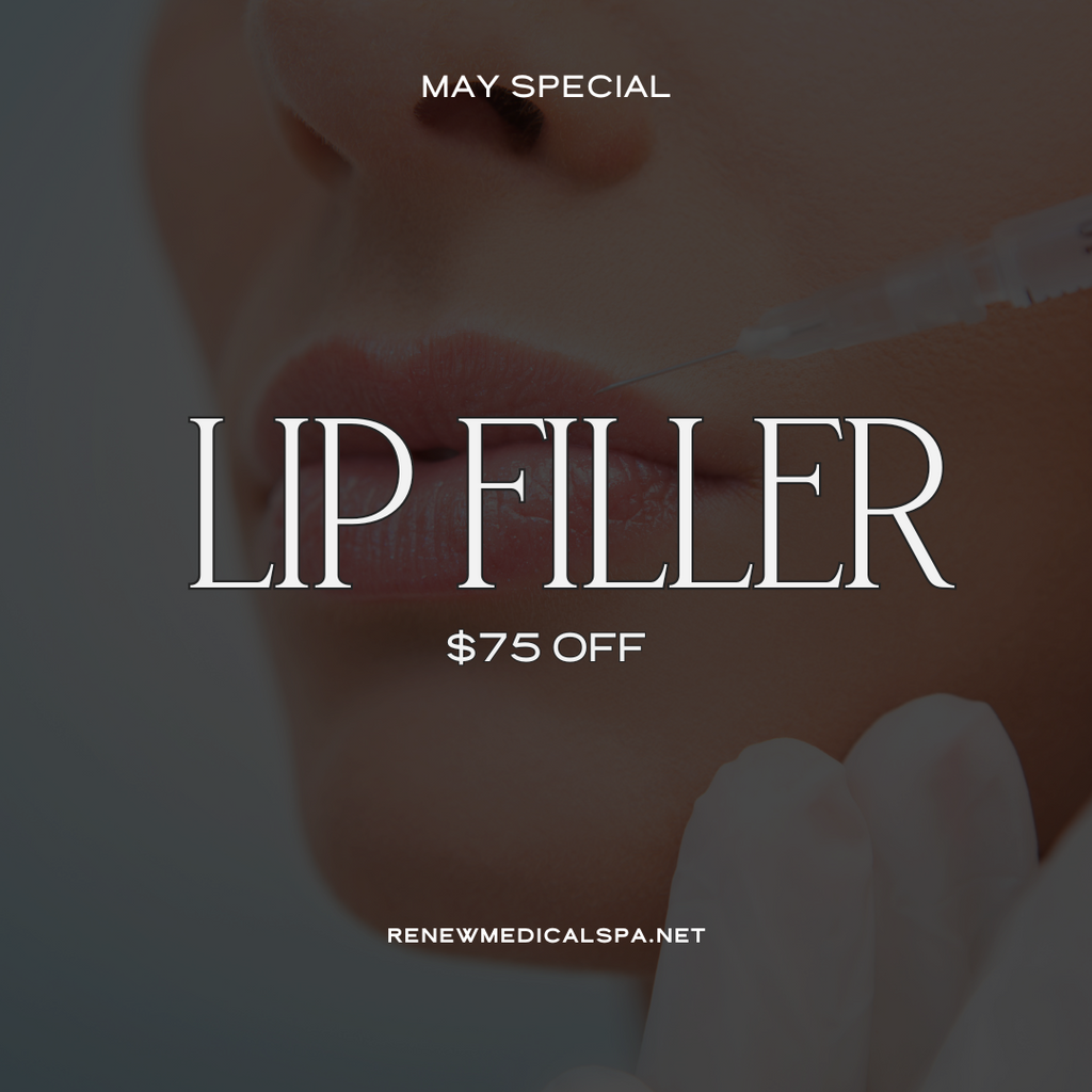 Lip Filler $75 Off